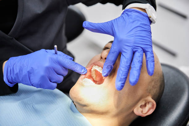 Best Emergency Dental Care for Broken or Chipped Teeth in Peshtigo, WI