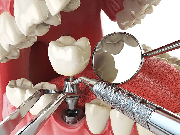 Best Emergency Gum Treatment in Peshtigo, WI